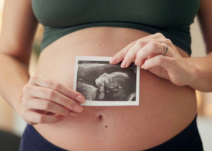 Hands, house and pregnant woman with ultrasound, maternity and wellness in living room. Closeup, pregnancy and girl with baby scan, apartment and excited for future, growth and prenatal with sonogram